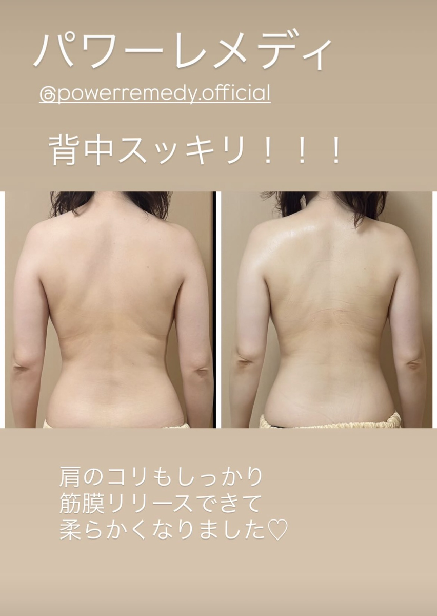 施術後のビフォーアフター画像