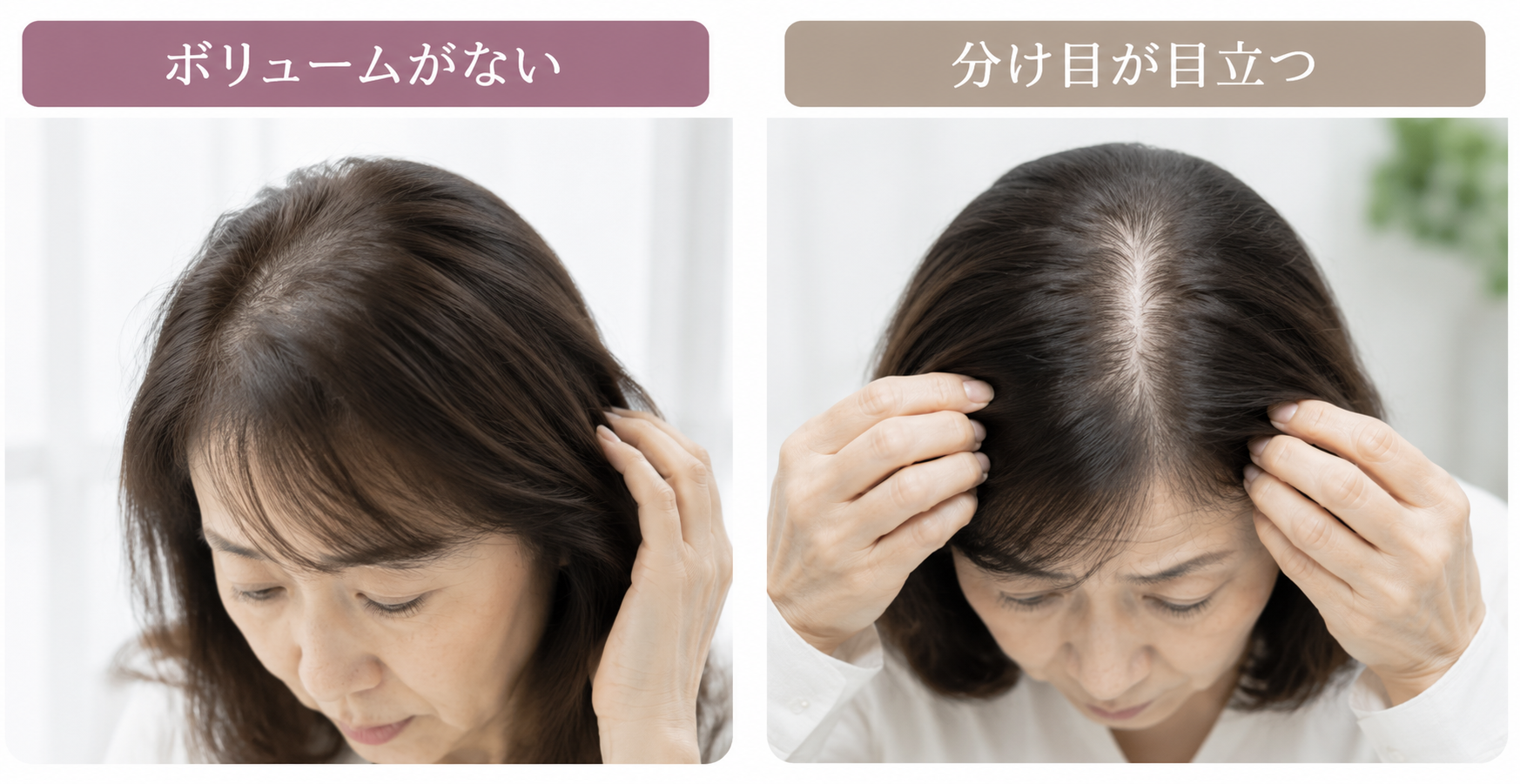 ボリュームダウン、分け目が目立つ画像