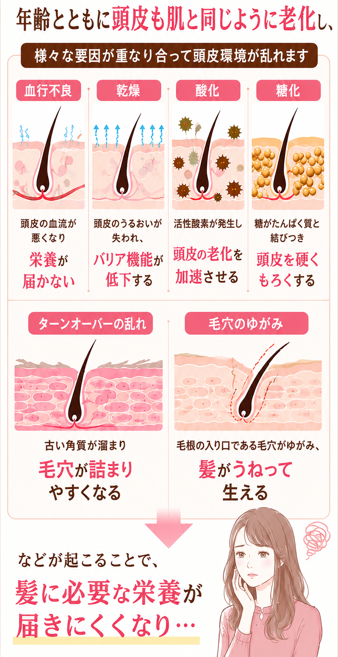 エイジングサインが髪の毛に出る要因(血行不良、乾燥、酸化、糖化、ターンオーバーの乱れ、毛穴のゆがみ)を解説した画像