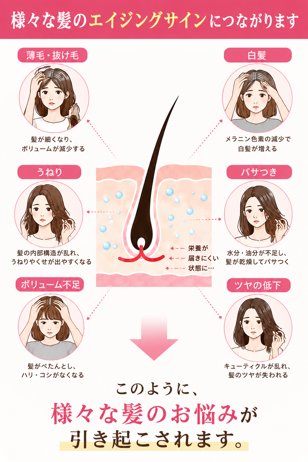 エイジングサイン(薄毛・抜け毛、白髪、うねり、パサつき、ボリューム不足、ツヤの低下)が起きている図解