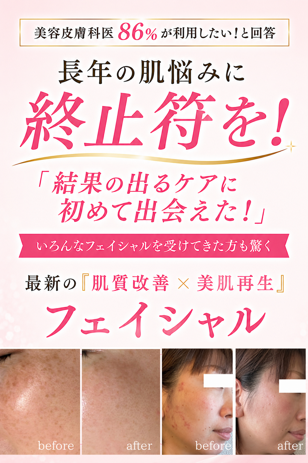 ヘッダー画像（長年の肌悩みに終止符を！「結果の出るケアに初めて出会えた！」いろんなフェイシャルを受けた方も驚く、最新の「肌質改善×美肌再生」フェイシャル）
