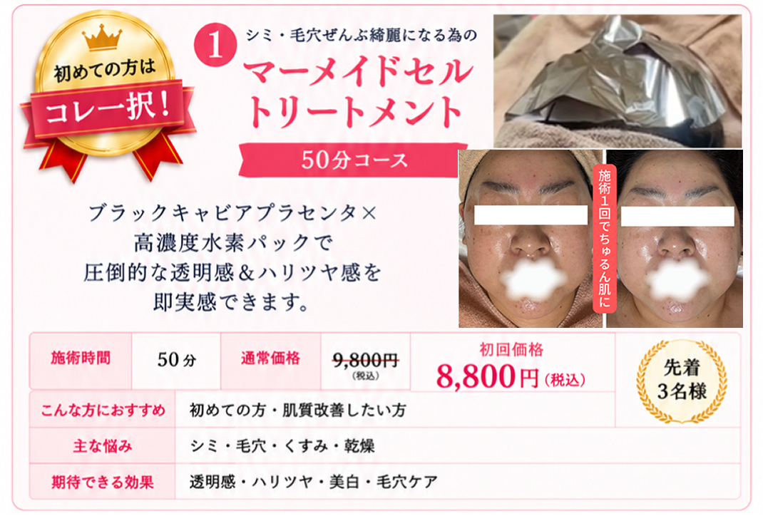 初めての方はコレ一択です。の画像