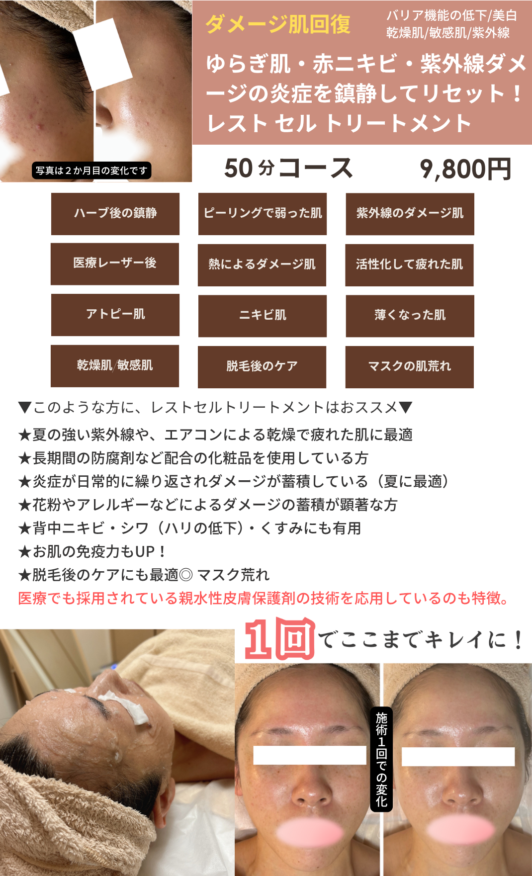 レストセルトリートメントの画像