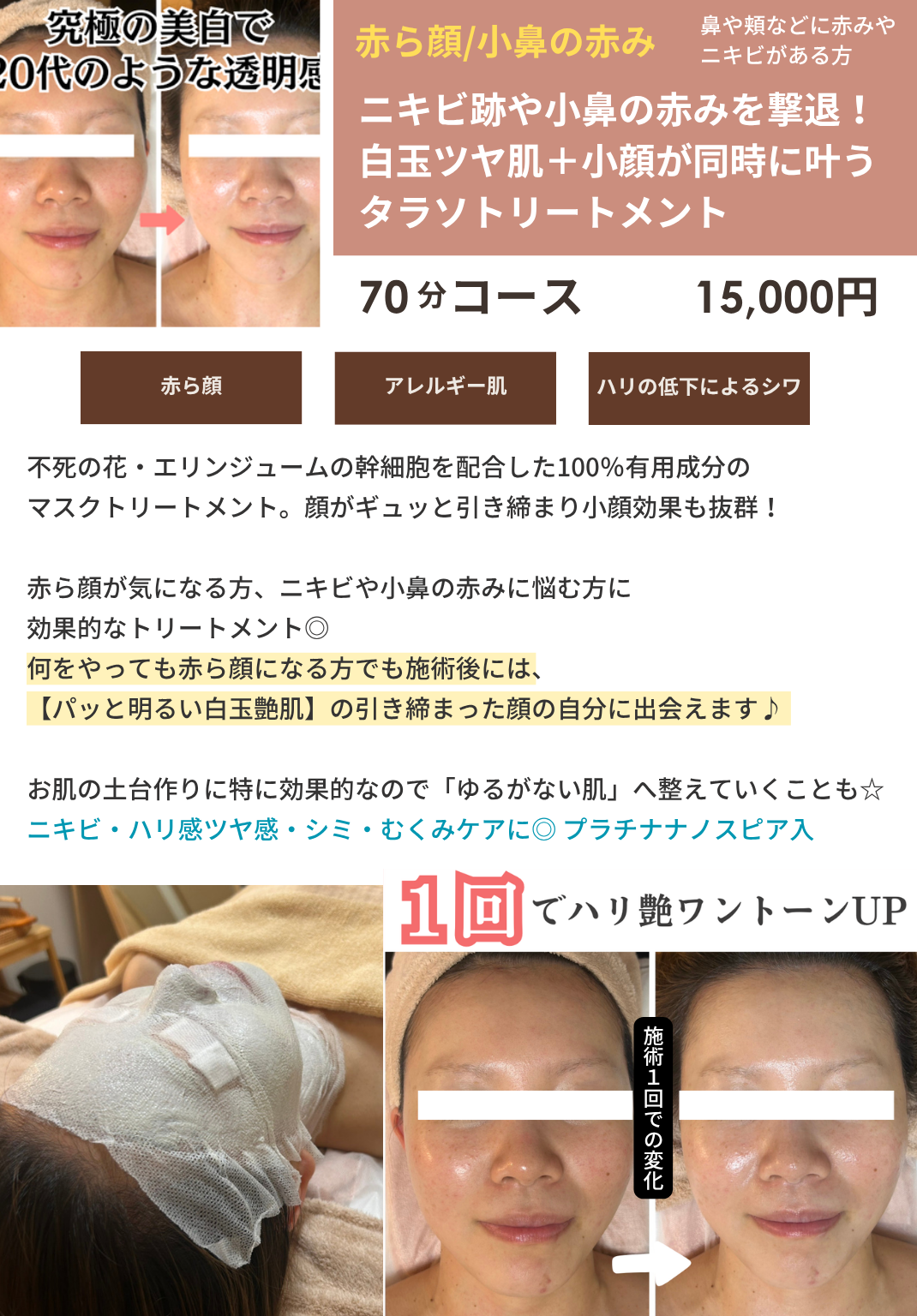 タラソトリートメントの画像