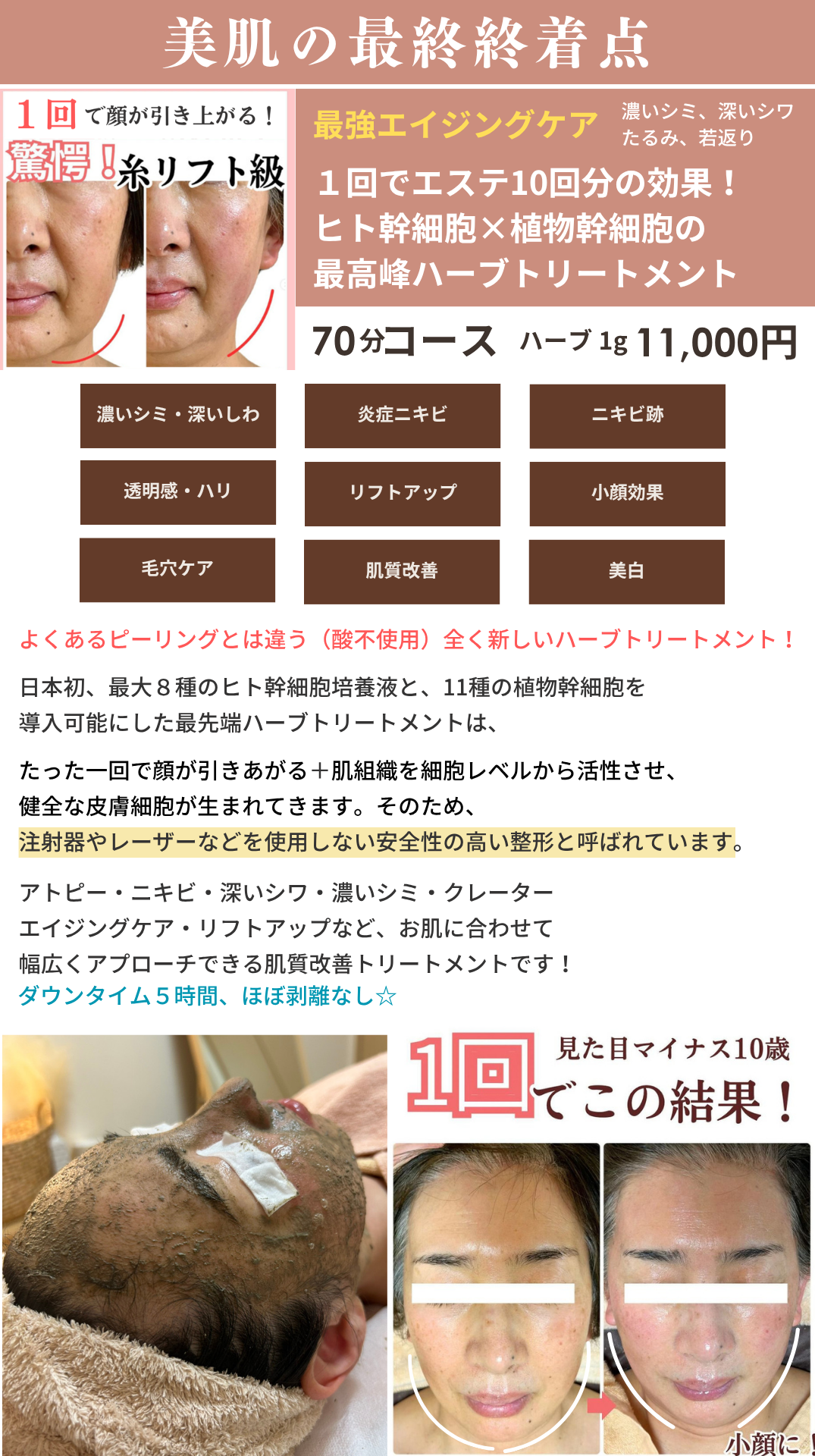 ハーブトリートメントの画像