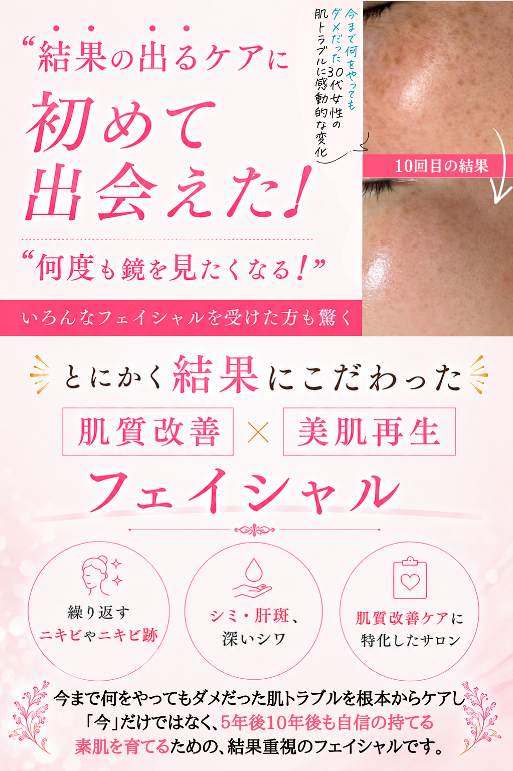 ヘッダー画像(何度も鏡を見たくなる!と喜びの声が続出…諦めていた肌の悩みを根本から改善する「肌質改善×美肌再生」フェイシャル)