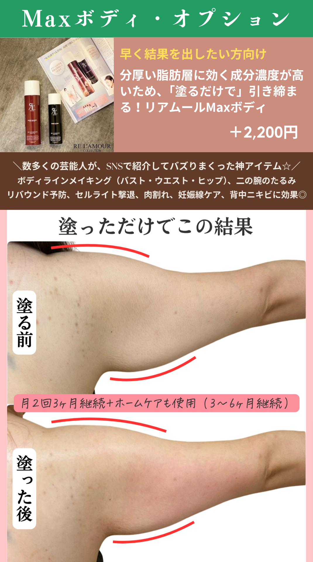 オプションメニュー「リアムールMaxボディ」の画像