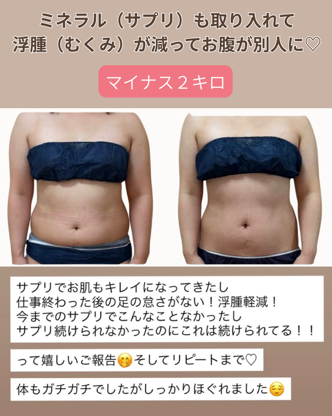 ミネラルを取って、むくみが解消したお客様のビフォーアフター写真1枚目
