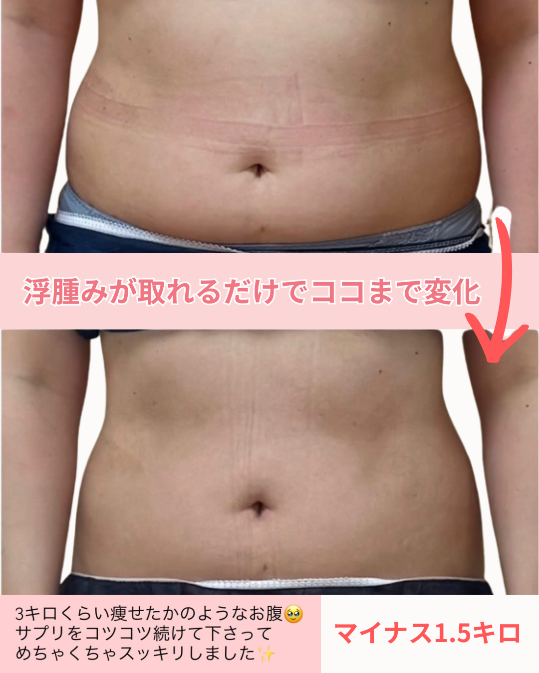 ミネラルを取って、むくみが解消したお客様のビフォーアフター写真2枚目