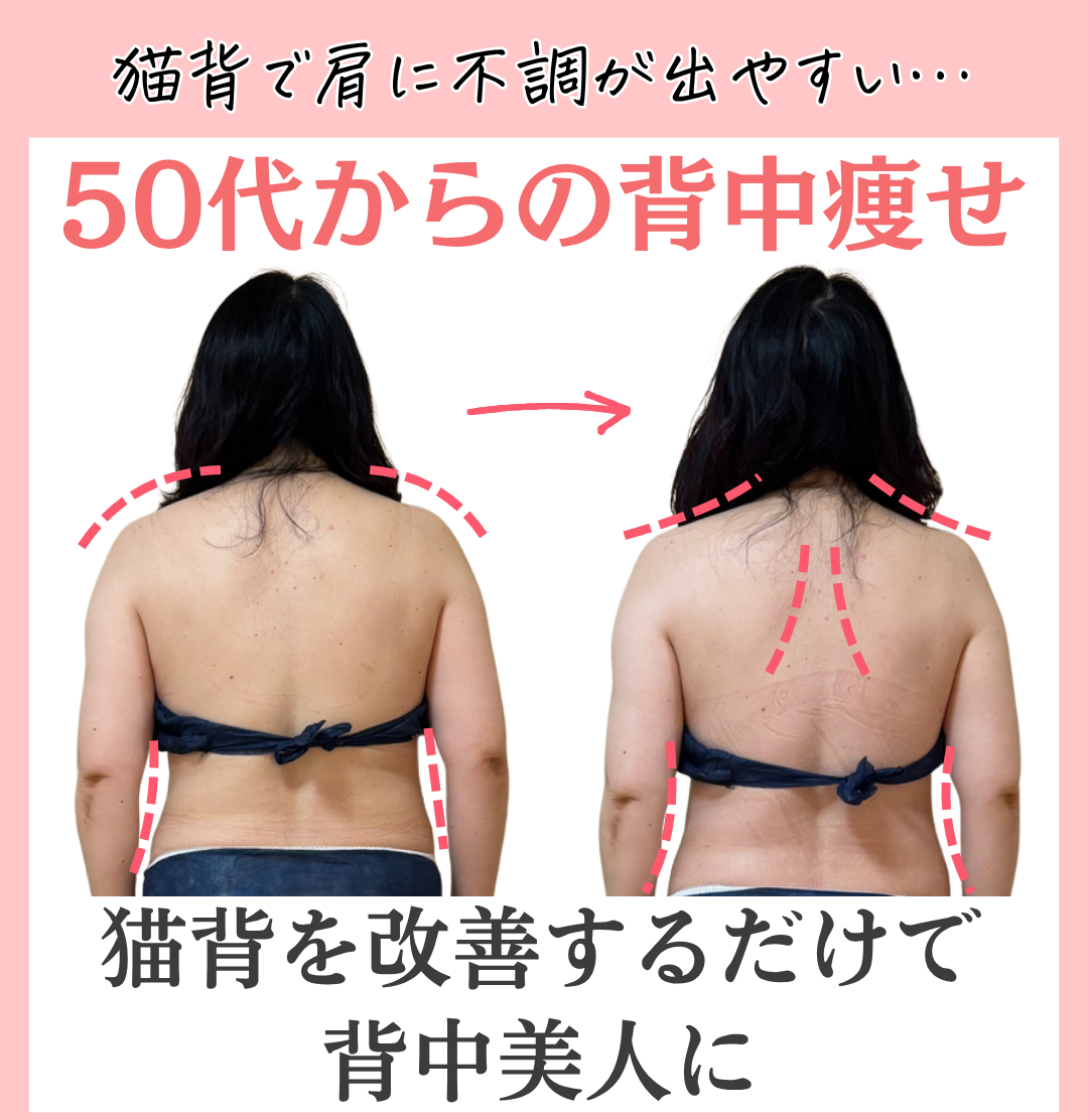 猫背を改善して痩せたビフォーアフター（背中側）