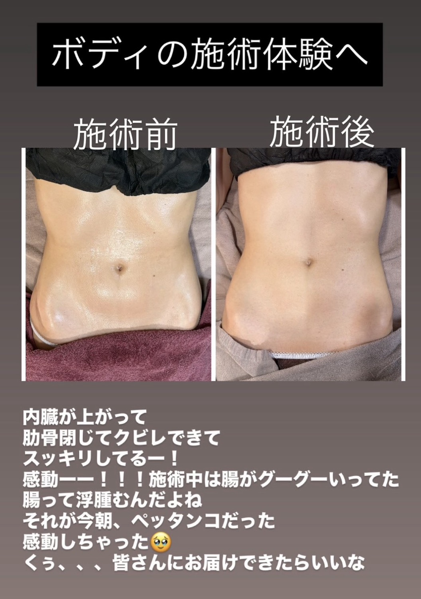 パワーレメディを受けた時のビフォーアフター写真