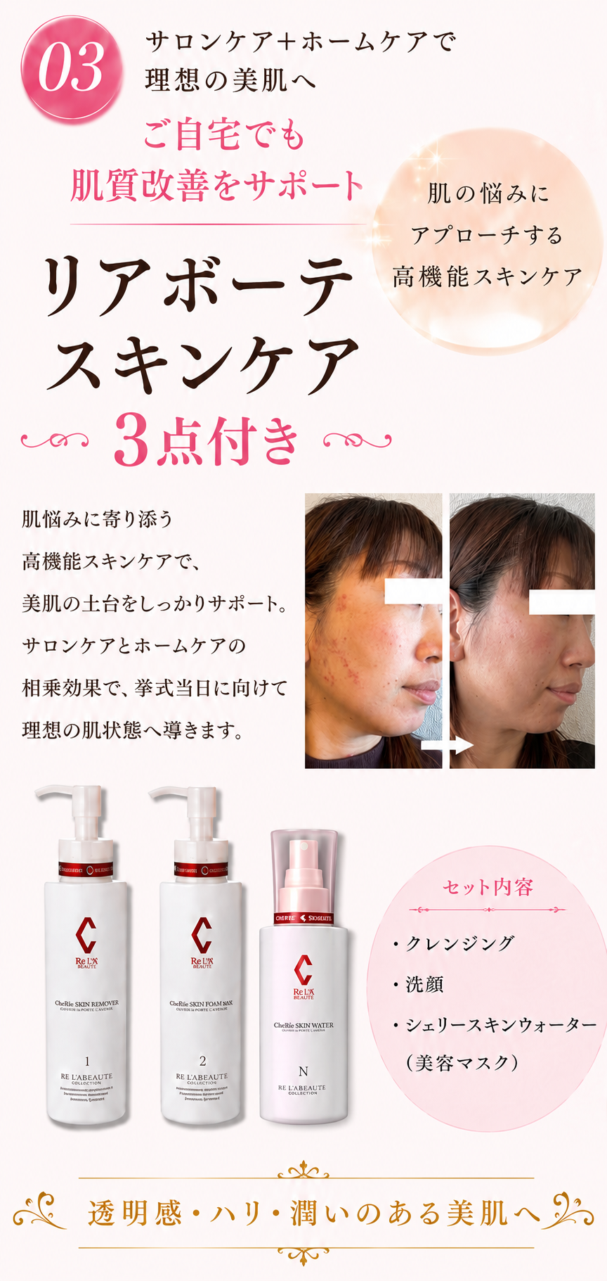 スマホ用画像(③さらに、ご自宅でも肌質改善をサポートできるリアボーテのスキンケア3点付き。サロンケアとホームケアを組み合わせることで、挙式当日に向けて理想の肌状態を目指します。)