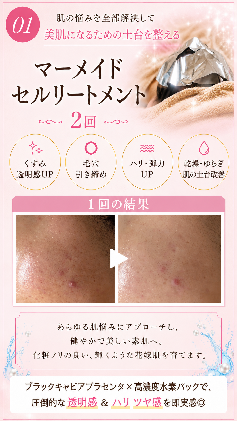 スマホ用画像(①肌の悩みを全部解決して、美肌になるための土台を整えるマーメイドセルトリートメント)