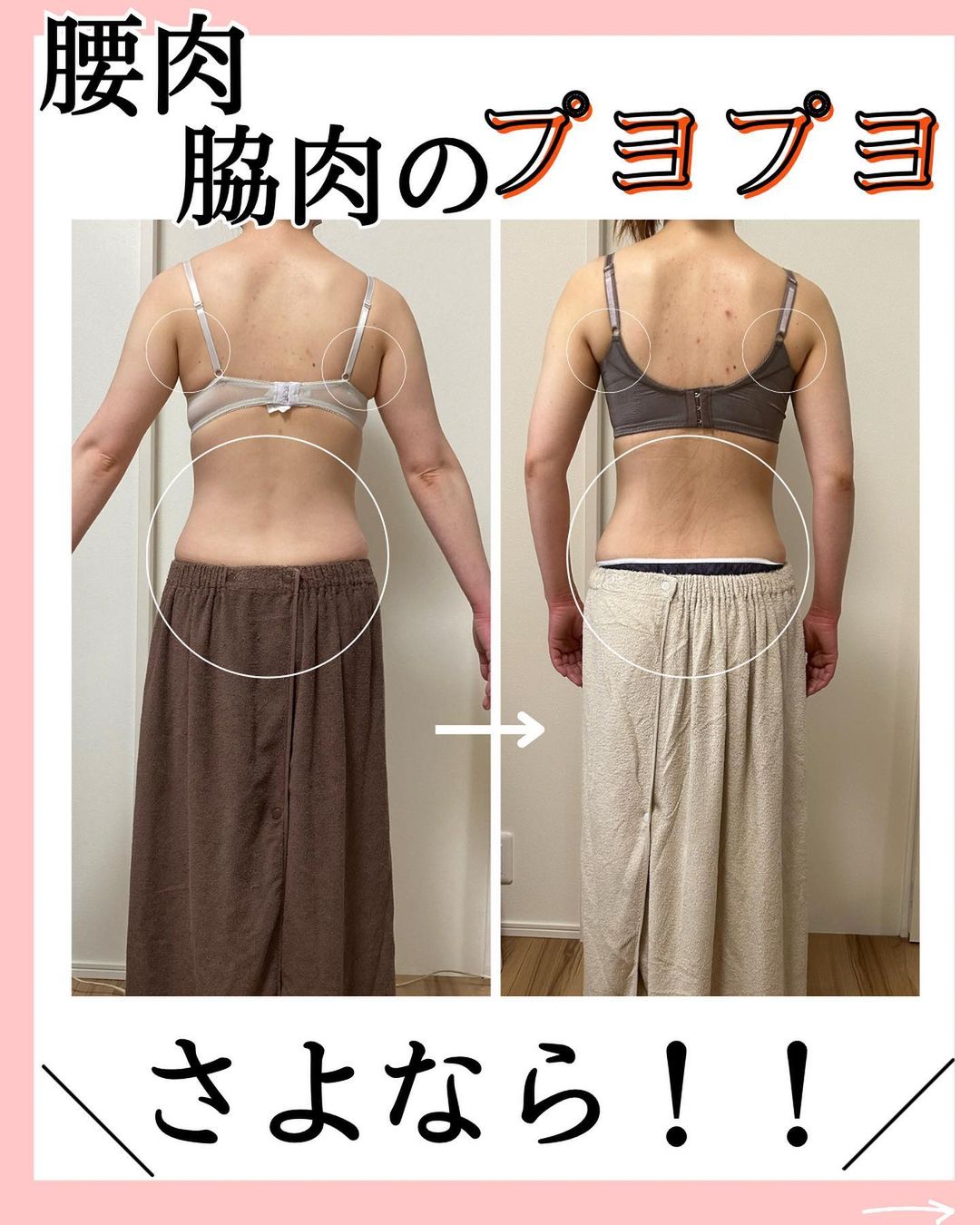 【30代女性】10回コースのビフォーアフター画像
