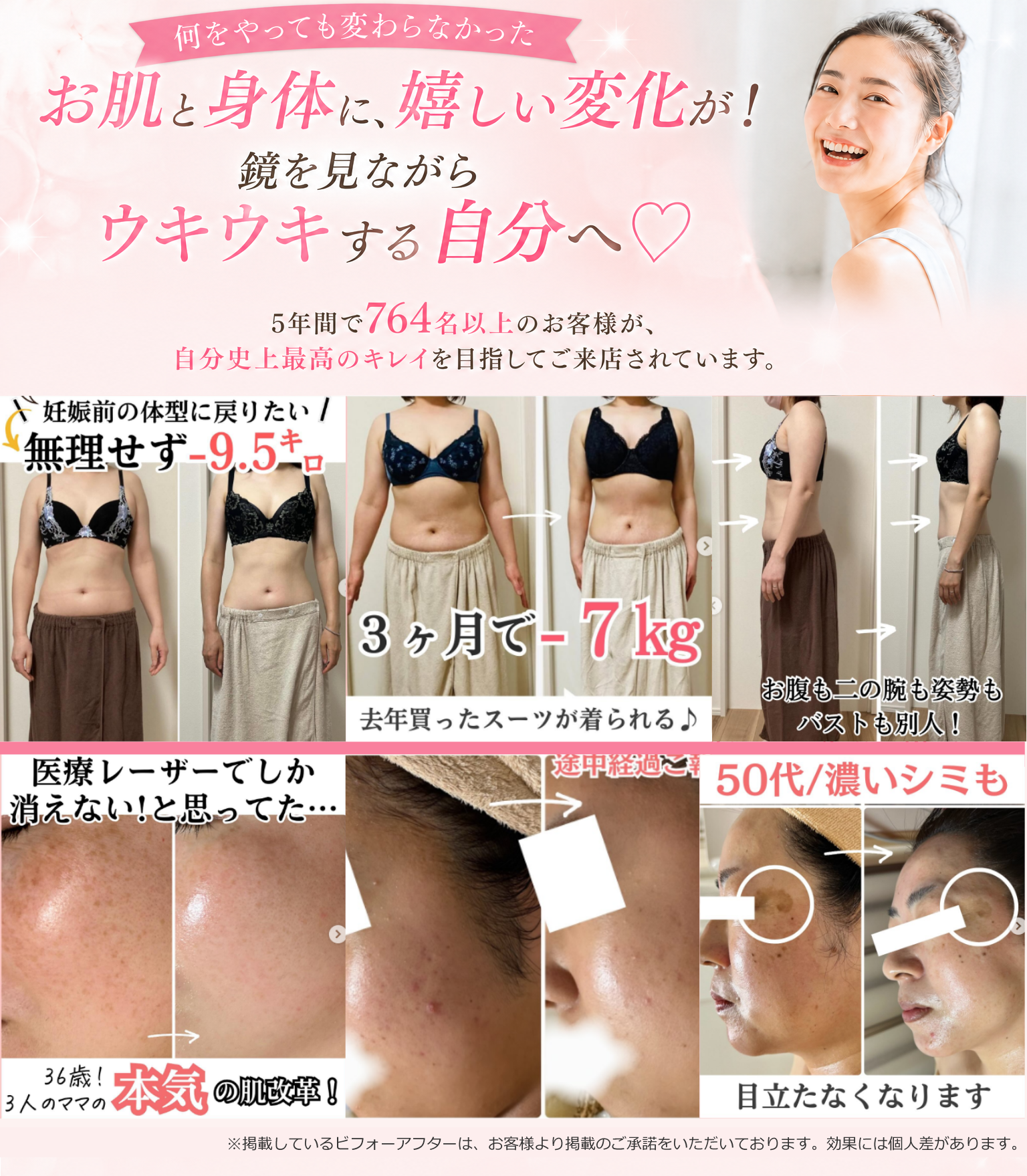 お客様の肌と身体のビフォーアフター写真
