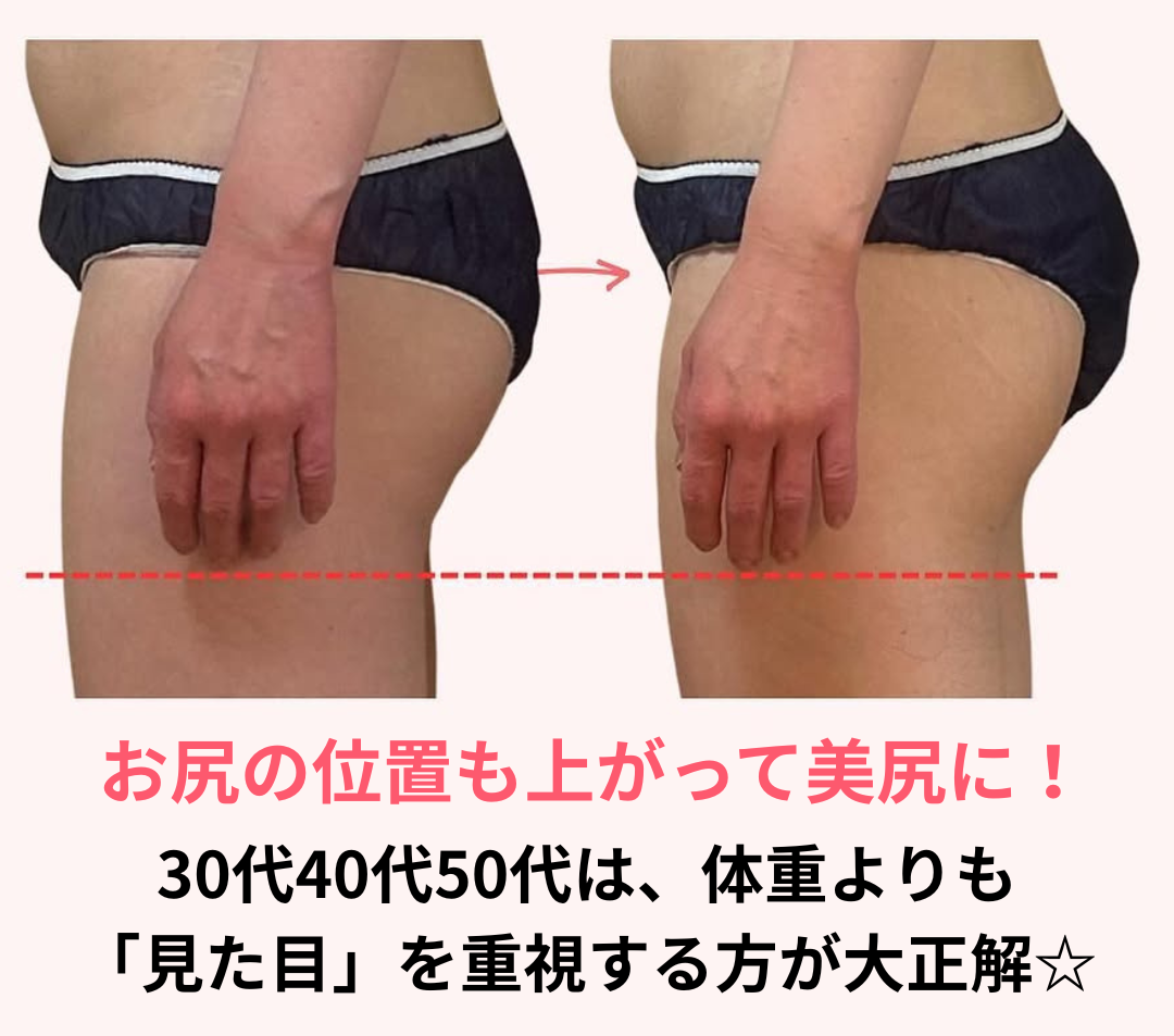 お尻の位置も上がったビフォーアフタ写真