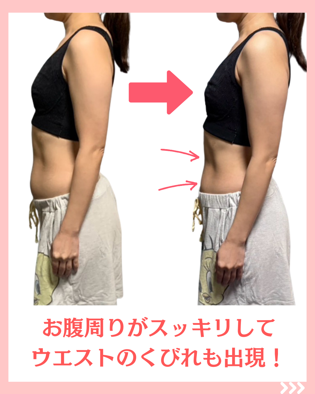 横から見た、２日でぽっこりお腹・下腹痩せ解消したビフォーアフター写真