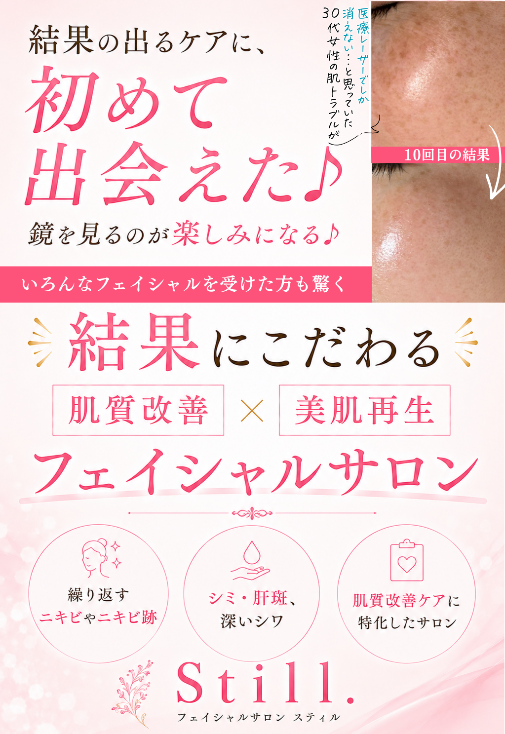 ヘッダー画像（結果の出るケアに、初めて出会えた♪鏡を見るのが楽しみになる♪ いろんなフェイシャルを受けた方も驚く、結果にこだわる「肌質改善」×「美肌再生」フェイシャルサロンStill.）