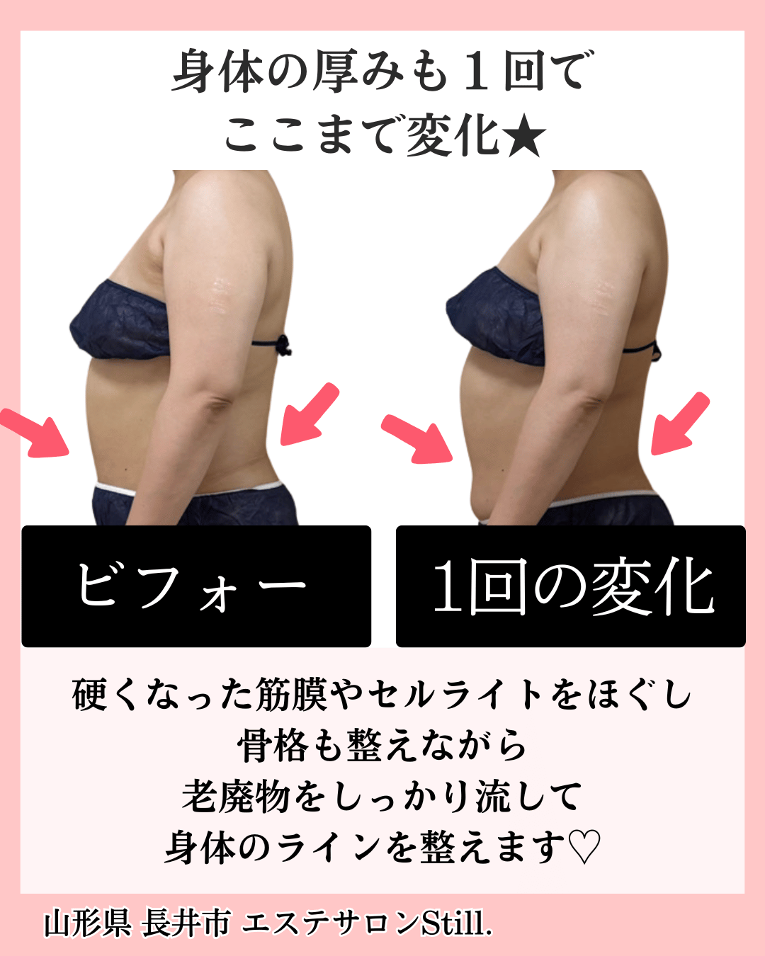 パワーレメディのビフォーアフター写真２枚目