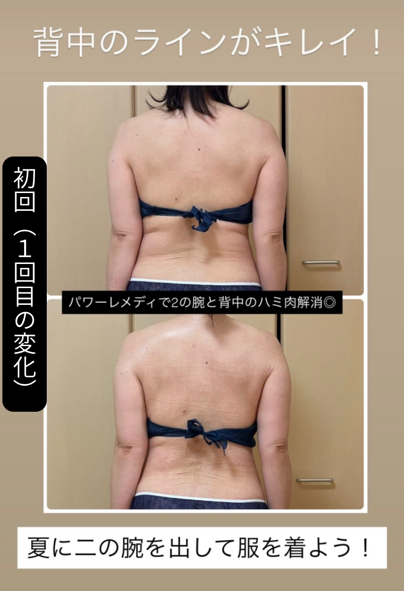 パワーレメディ１回の変化のビフォーアフター写真（事例２）