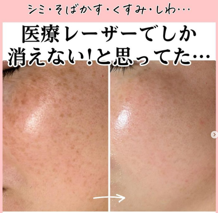 フェイシャルのビフォーアフター画像